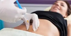 سفید کردن واژن در آمل