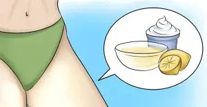 سفید کردن واژن در آمل